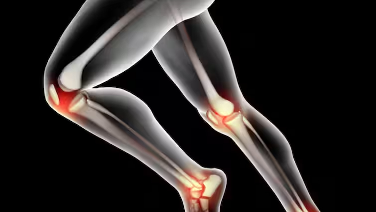 आपके घुटनों की सेहत बिगाड़ रहीं ये आदतें, आज से ही बदल लें ये बैड हैबिट्स